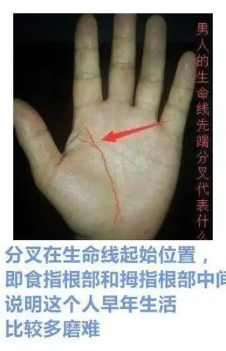 手相生命线起始分叉,幼年体弱多病,事业多波折,婚姻不顺心
