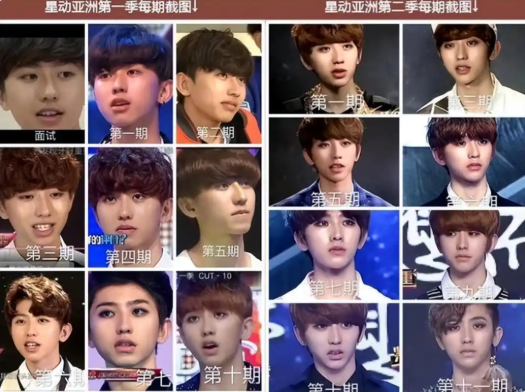 蔡徐坤整容实锤?前东家晒整形费用明细,成长变化图