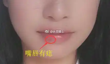 女人嘴唇上长痣面相图解女人嘴唇上有痣代表什么嘴唇上有痣面相