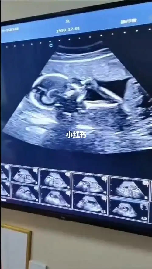 18周的胎宝宝吃手手好可爱呀