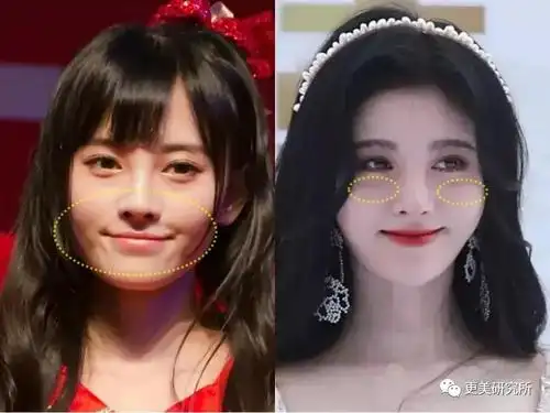 早期鞠婧祎脸上虽然有婴儿肥,但苹果肌位置却干