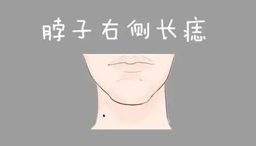 痣长在颈左边有福气图