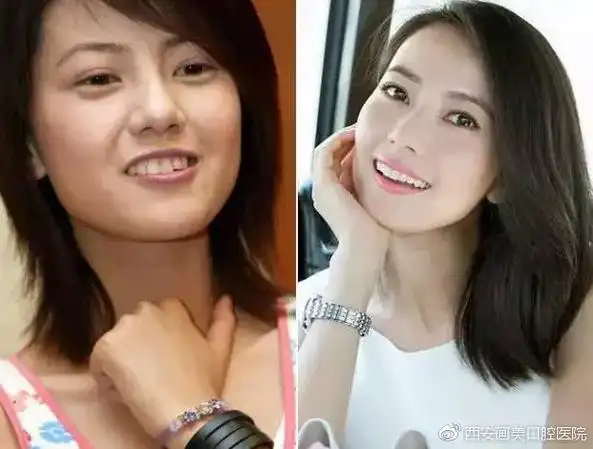 为什么偏偏我有地包天,别人却没有?67-李永峰-爱问医生