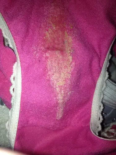 内裤上白白的是什么