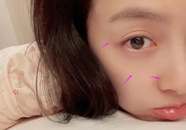 宋茜素颜皮肤白皙嫩成鸡蛋羹,4年前素颜逛街照招人"恨"!