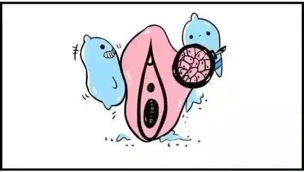 妇女之窗丨警惕少见妇科恶性肿瘤:外阴癌_治疗_检查_女性