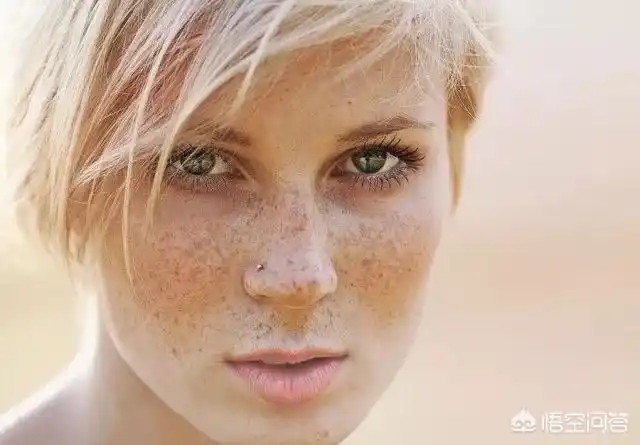 白种人相较于黑种和黄种人更易长雀斑,这是因为在三个人种当中,黑种人