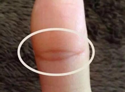 凤眼纹没封住是啥意思其实很好理解