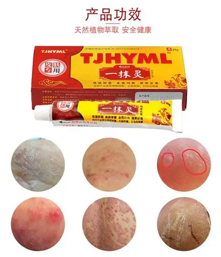 一抹灵乳膏一摸灵软膏脚气脚痒大腿内侧藓痒瘙痒皮肤