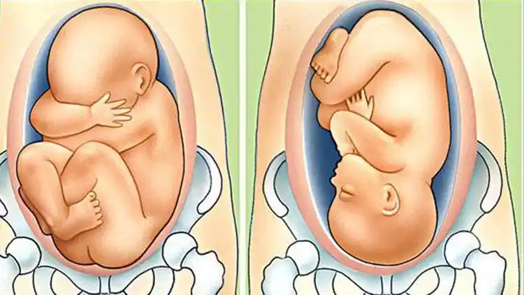 胎儿入盆有早也有晚,入盆时间与这4点分不开!孕妈要了解