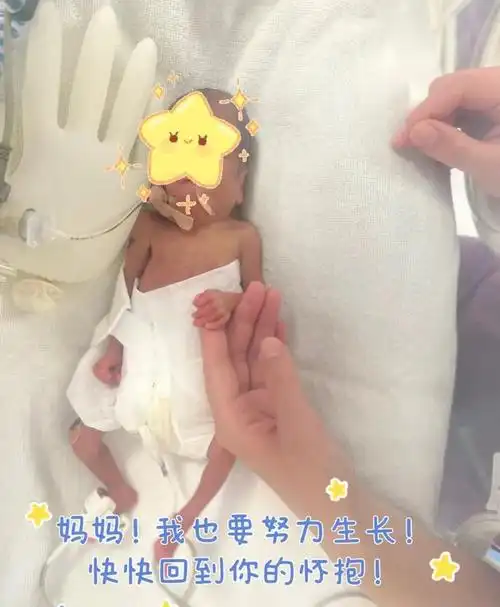 揪心开封这个胎龄仅253周的极早早产儿