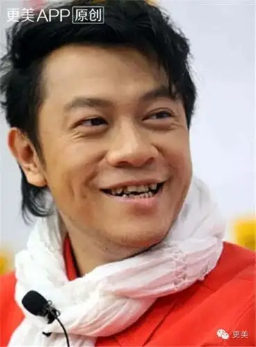 娱乐圈烂牙王大比拼!烂牙明星大曝光!