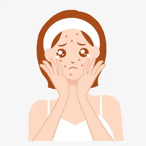 躲不开的痘痘到底怎么躲开