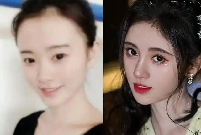 鞠婧祎鼻子又变高了被质疑整容看完这张照片瞬间明白了太心疼