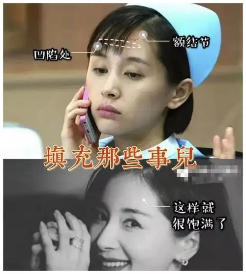 王子文美商太高填充成功回到18岁为啥娄艺潇变发面馒头