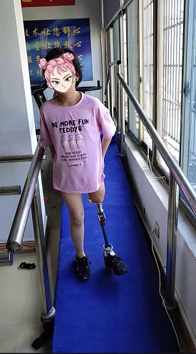 儿童假肢