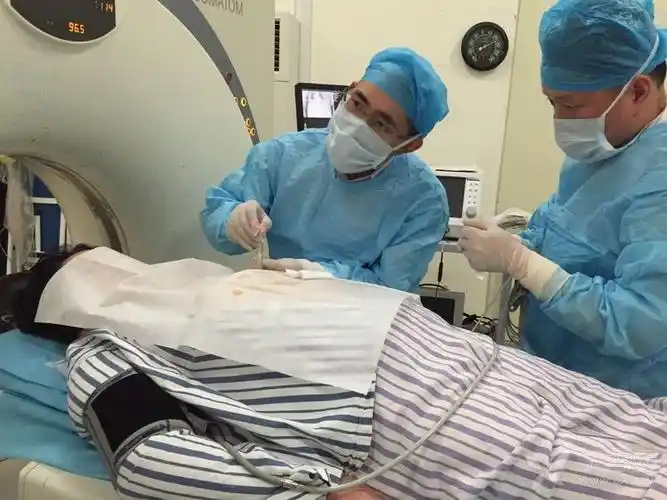 水手告别仪式:ct引导下在背上两根细针穿刺