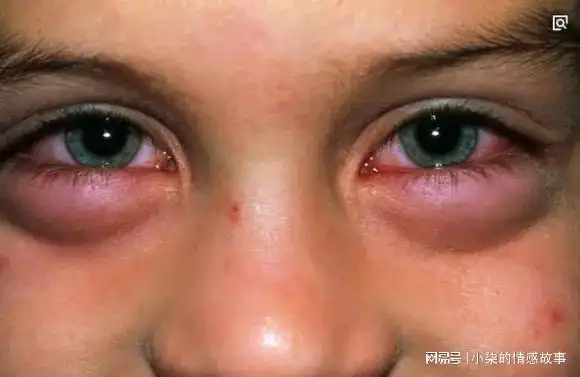 尿毒症到来前身体可能会发生这3个信号多数人可能没察觉