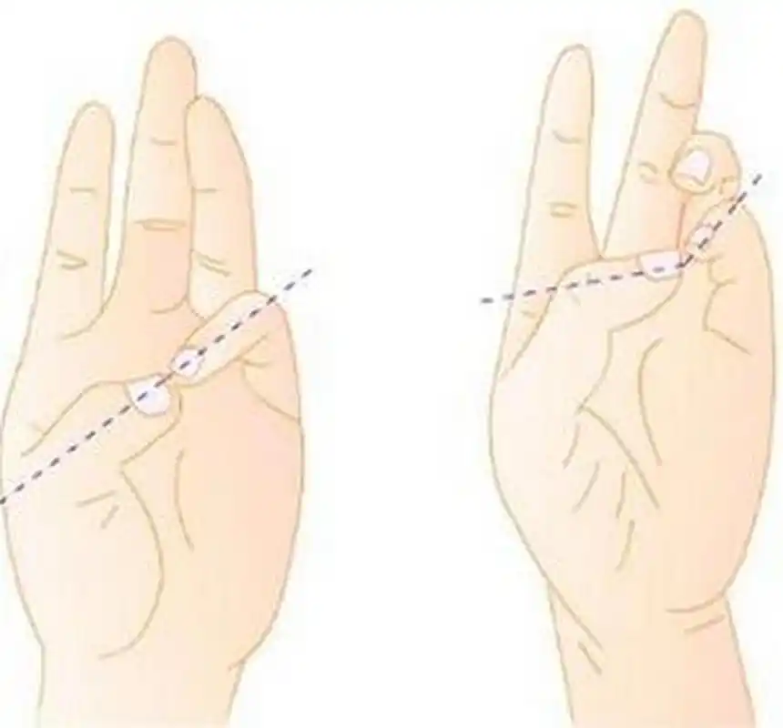 科普知识竞赛#拇指对掌试验是让拇指末节指腹与小指末节指腹面面相对