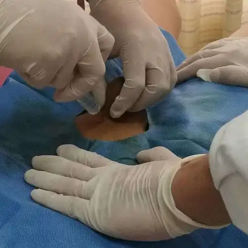 新桥医院陈医生给您讲解包皮过长,包茎及包皮环切术_包皮过长_手术