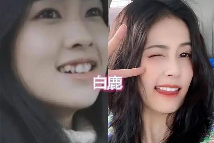 整牙前vs整牙后,这些明星的一些小调整,就有不同的气质出现_牙齿_杨幂