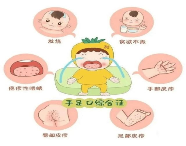 春夏季常见传染病预防_传播_人群_呼吸道