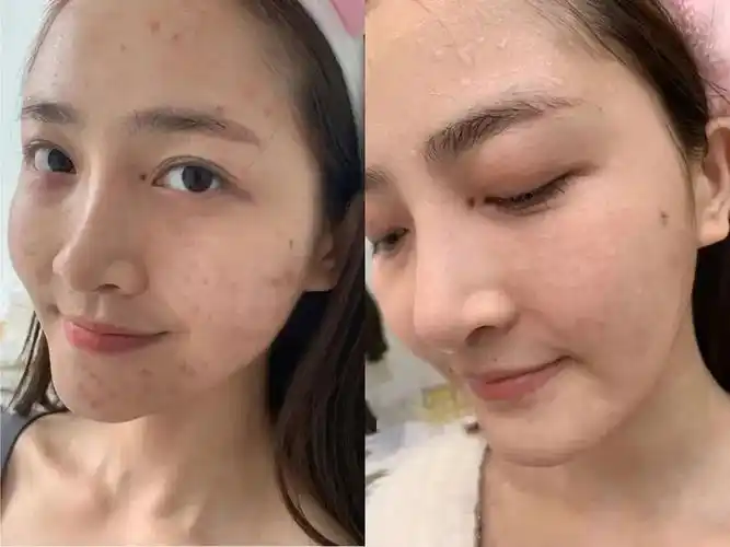 睡前有这个习惯的女生,皮肤越睡越好!