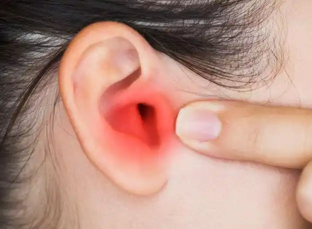 频繁出现耳朵发痒并伴有耳朵局部肿痛的现象或与3疾病有关