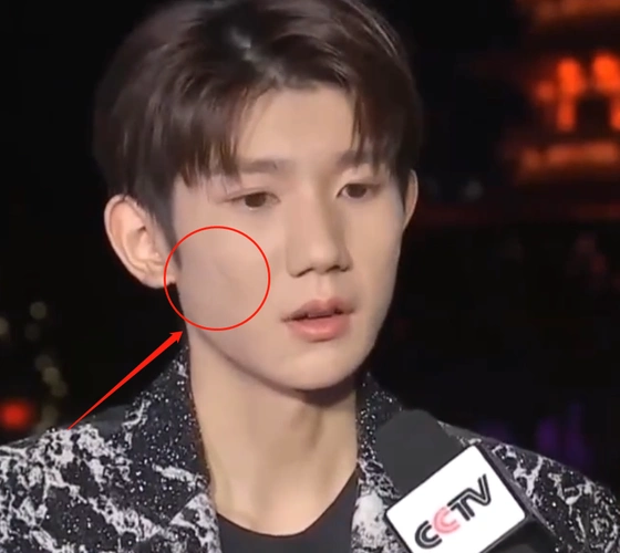 王源上央视节目无美颜直播暴露真实颜值这皮肤状态我没眼花