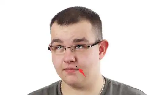 嘴角上方长痣嘴角上方长痣,属于典型的桃花痣,能够给