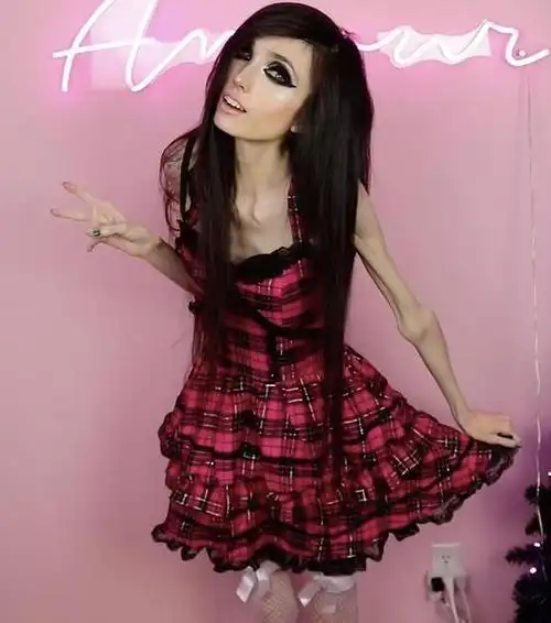 国外厌食症美女走红:瘦到皮包骨也要扮芭比