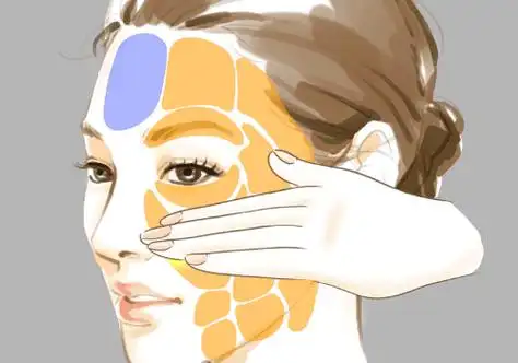 自体脂肪填充的风险有哪些?包括血肿,肿胀,凹凸不平,硬结等等