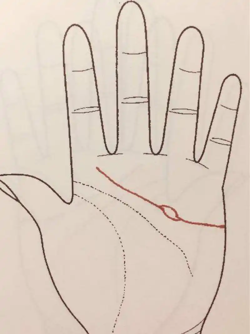 岛纹出现在掌纹上的寓意 1,岛纹在生命线上,代表着疾病缠身,是不健康