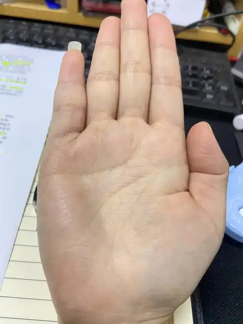 不知道什么时候开始多了这么多杂乱无章的细纹,生命线也分叉了以前没