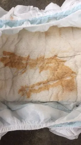 宝宝呕吐拉肚子吃了药尿尿是褐色有粉末