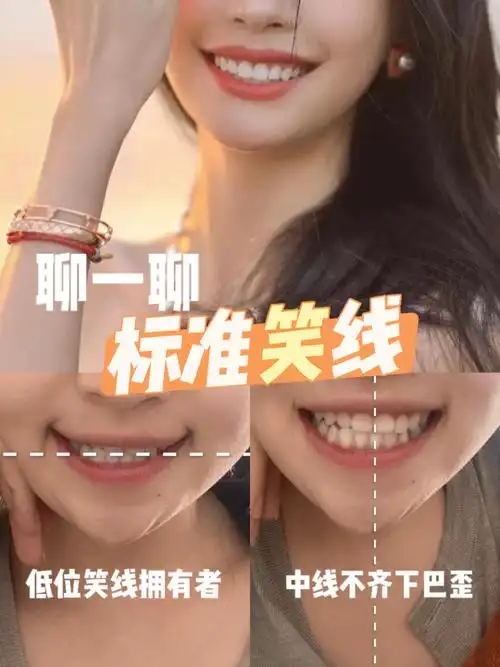 标准牙齿咬合图片