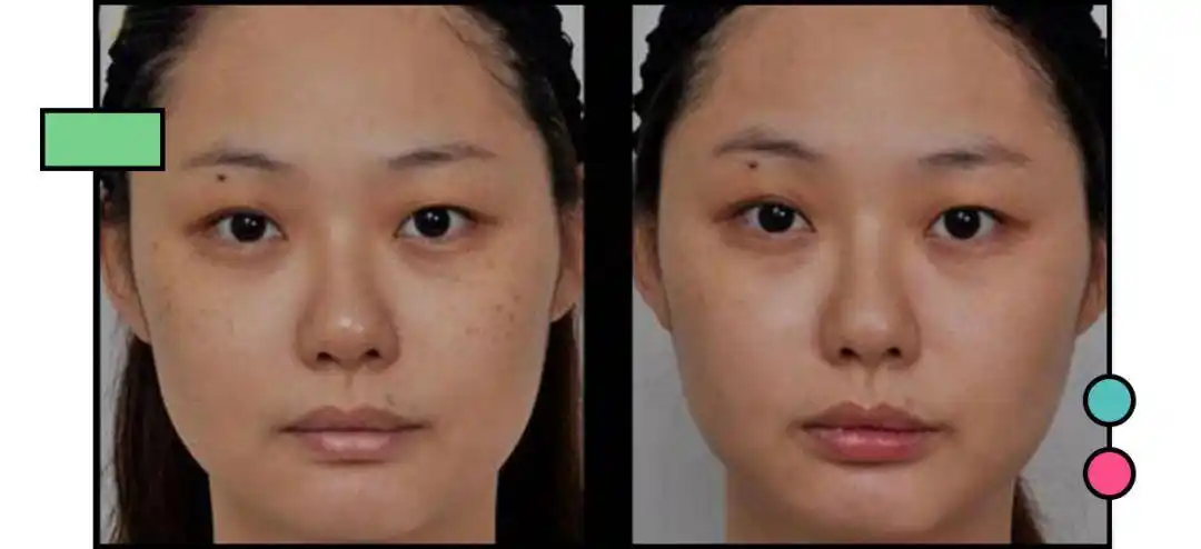 暗沉的话是比较扁平的因为黄种人的五官皮肤粗糙和缺乏光泽感等等一般