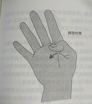 在一些儿童中,拇指第一指关节(ip关节)伸展,而拇指的掌指关节(mcp指