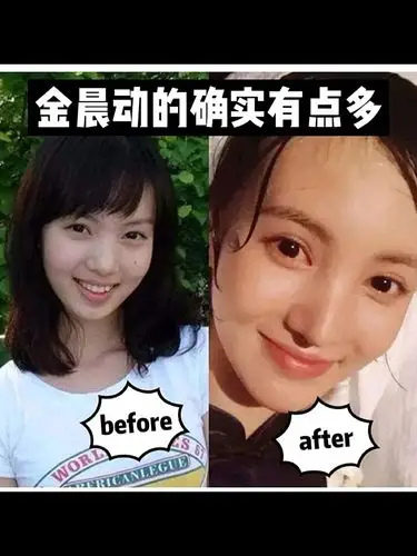 金晨这脸上动的也太多了吧999595明星整容|乘风破浪的_圈子