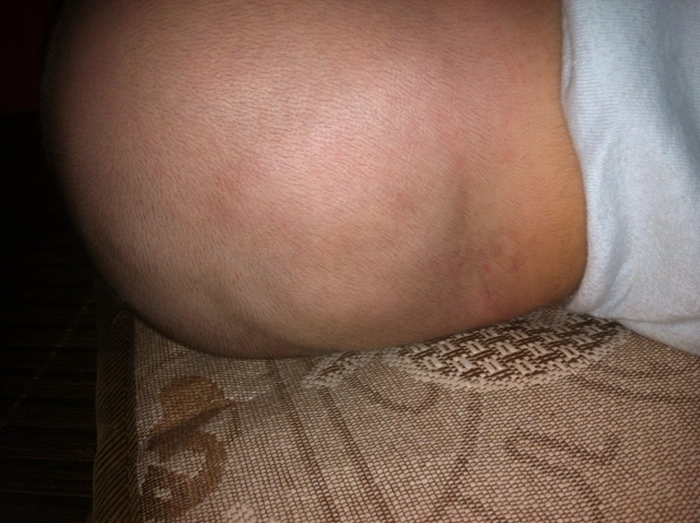 快四个月,宝宝的后脑勺,如图