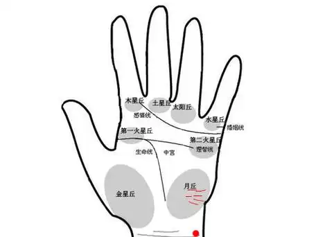 (除了妊娠三个月),手腕线下一厘米,离外侧一厘米处,有搏动感月丘松垂