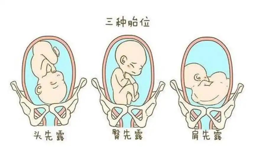 loa胎位生男比生女多的依据是什么