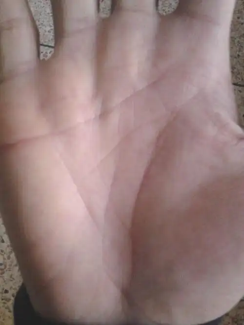 手相生命线岛纹