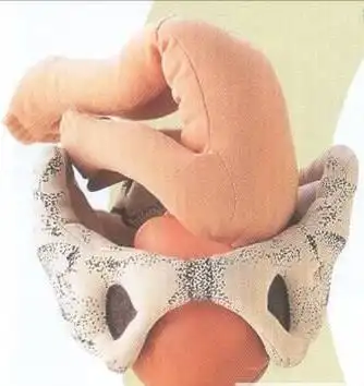 要顺产的妈妈看过来,宝宝入盆和娩出时的模拟图