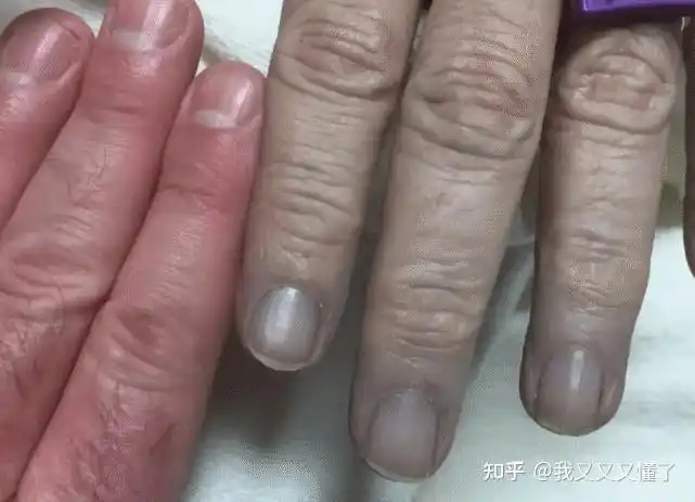 地球上或许真的存在"蓝种人"? - 知乎