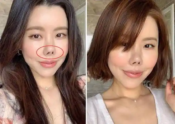 原创盘点整容失败的明星她整容后变成猪鼻韩女星现状惨不忍睹