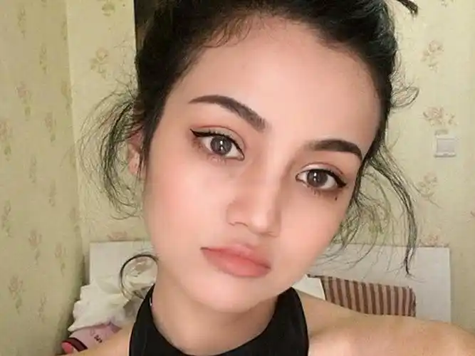 🌈之前做的重睑不满意,觉得太窄了,就重新做了一个,_圈子-新氧美容