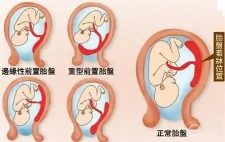 胎盘的位置就固定下来了,胎盘和脐带在受精卵附着的位置开始逐渐形成