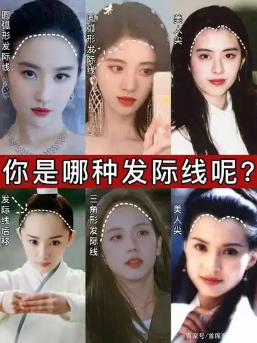 几种常见的发际线,你又是哪一种呢?几分钟教你植发如何选发际线