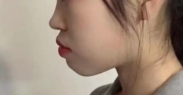 孩子长大颜值高不高就看这个地方,别错过孩子颜值"逆袭黄金期"